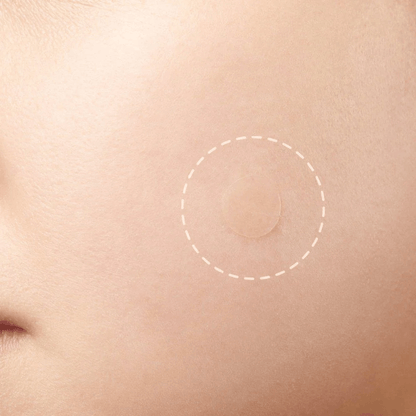 Acné Pimple Master Patch 15 uds